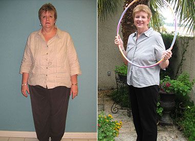 Joanne's Before & After Weight Loss
