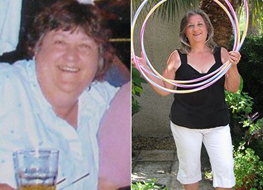 Phyllis before & after weight loss