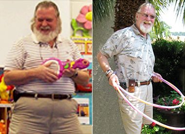 mark before and after weight loss surgery
