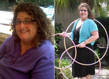 Cynthia  Weight-loss Before & After