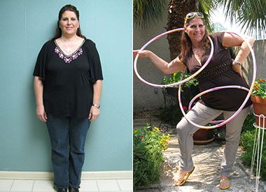 Lori's weight loss before and after Dr. Kent